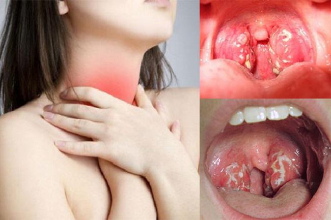 Top 7 bệnh lý tai mũi họng thường gặp nhất hiện nay