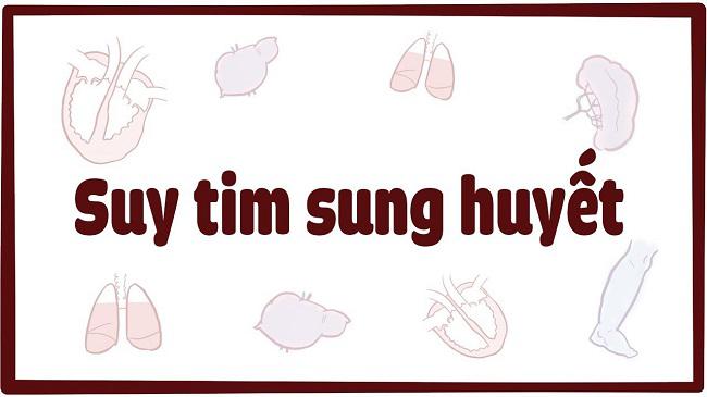 Bệnh suy tim sung huyết và những điều bạn cần biết