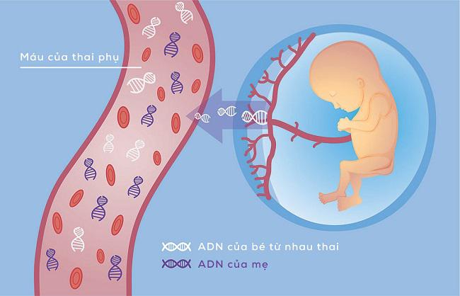 Sàng lọc tiền sinh tại Bạc Liêu - Kiểm soát gánh nặng dị tật