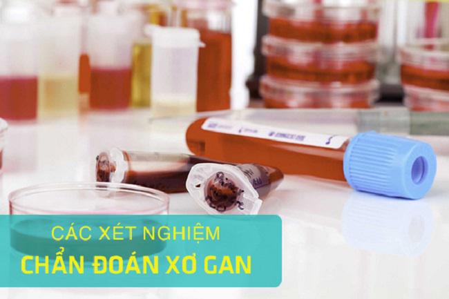 Làm thế nào để phát hiện sớm bệnh xơ gan?