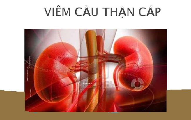 Viêm cầu thận cấp là gì? Nguyên nhân dẫn đến viêm cầu thận cấp