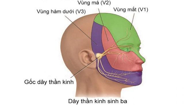 Đau dây thần kinh sinh ba và những biến chứng có thể bạn chưa biết