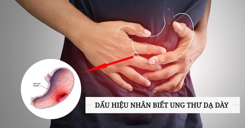 Nguy hiểm khôn lường nếu mắc phải bệnh ung thư dạ dày