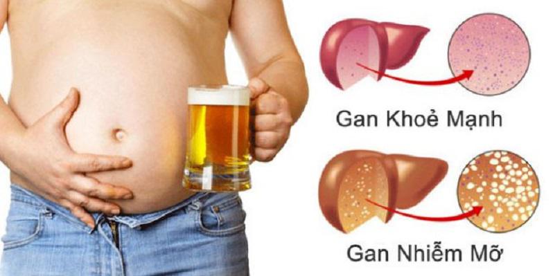 Cách bảo vệ lá gan khỏe mạnh