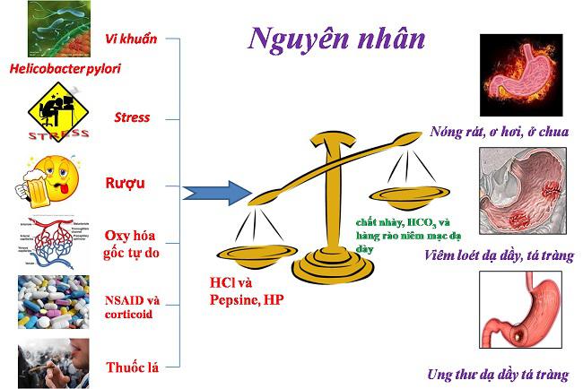 Những điều cần biết về bệnh viêm loét dạ dày tá tràng