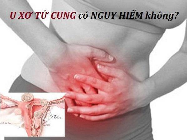 Phẫu thuật u xơ tử cung có nguy hiểm không?