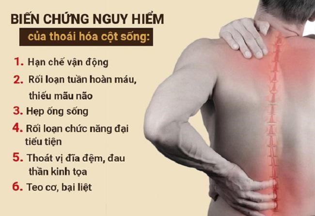 Khám và điều trị thoái hoá cột sống tại Bạc Liêu