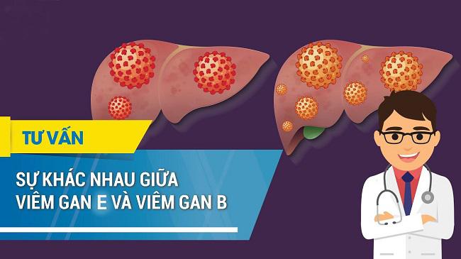 Viêm gan E và viêm gan B khách nhau như thế nào?