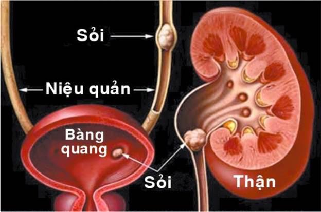 Đi tiểu nhiều lần trong ngày là bệnh gì?