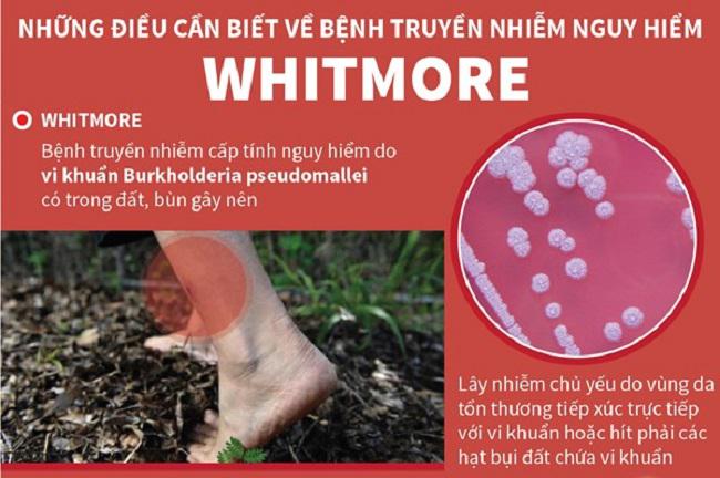 Phòng tránh bệnh Whitmore theo khuyến cáo của Bộ y tế