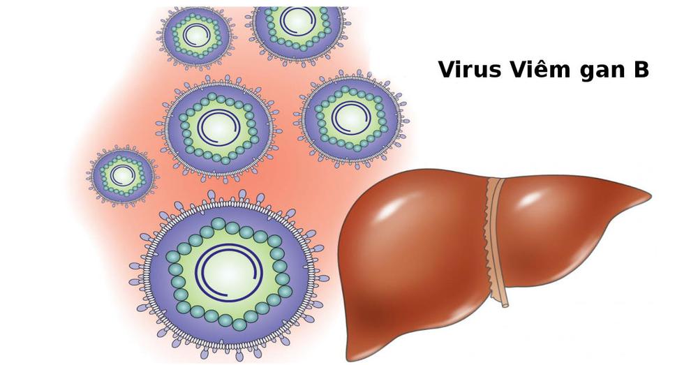 Viêm gan virus B là gì? Phòng tránh viêm gan B