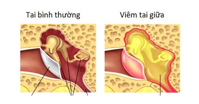 Top 7 bệnh lý tai mũi họng thường gặp nhất hiện nay